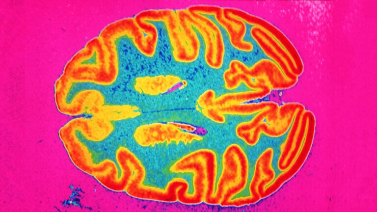 Colourful scans of brains