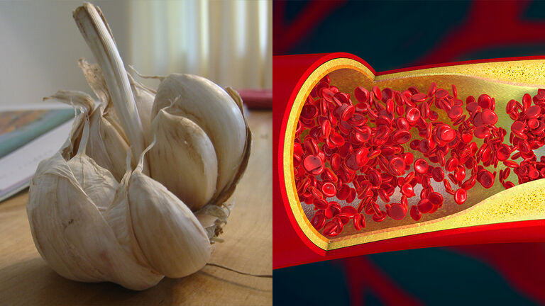 Garlic preventing blood clots