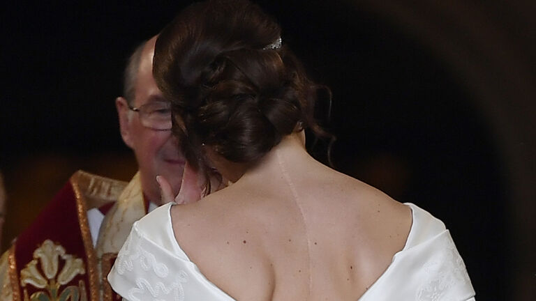 Princess Eugenie's scar