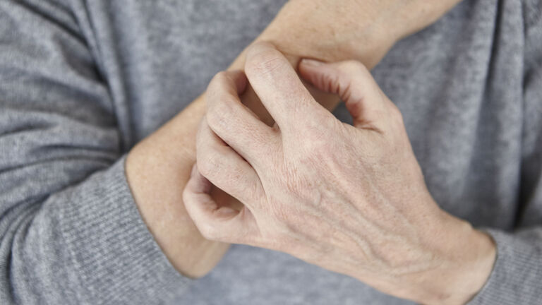 woman scratching arm