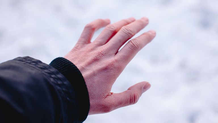Risk of frostbite of hand because of frost in winter