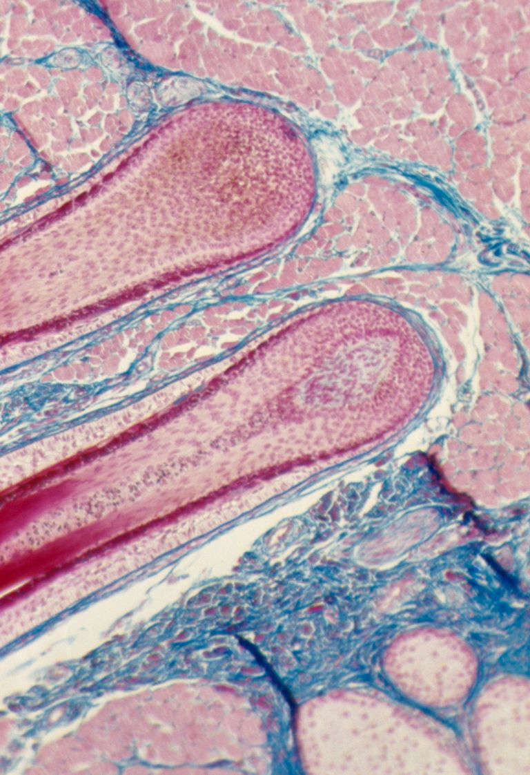 https://www.gettyimages.co.uk/detail/news-photo/microphotograph-of-a-longitudinal-section-of-bulbs-of-two-news-photo/170915866?phrase=eyelash%20microscope&adppopup=true
