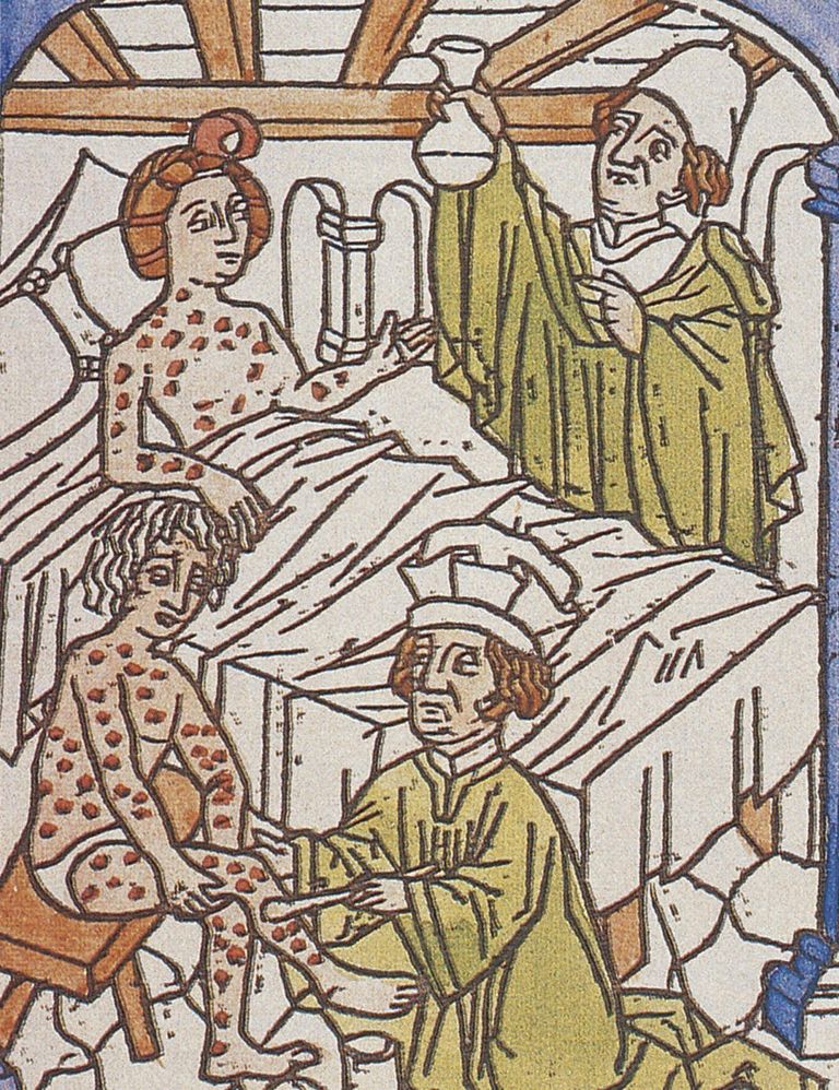 https://www.gettyimages.com/detail/news-photo/medical-treatment-of-syphilis-wood-engraving-title-page-of-news-photo/959158332