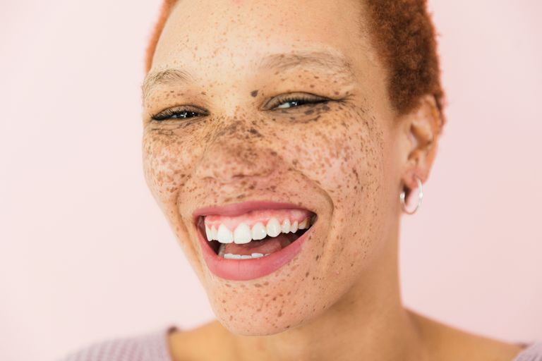 https://www.gettyimages.co.uk/detail/photo/close-up-photo-of-laughing-woman-with-big-smile-royalty-free-image/1379309414?phrase=red+hair+black+woman&adppopup=true
