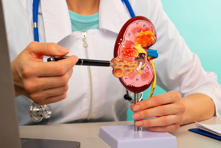 https://www.gettyimages.com/detail/photo/doctor-showing-pen-on-plastic-model-human-kidney-royalty-free-image/1709461561?phrase=kidney+disease