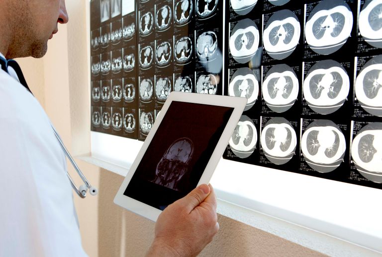 https://www.gettyimages.com/detail/photo/doctor-examining-mri-scans-royalty-free-image/163319037?phrase=IQ+test+MRI+