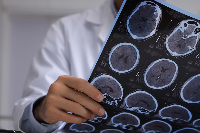 https://www.gettyimages.com/detail/photo/doctor-examining-mri-images-of-patient-with-royalty-free-image/1423600449?phrase=brain+surgery